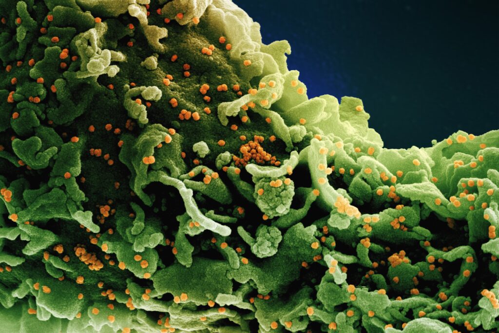 Electron microscope picture of a novel coronavirus